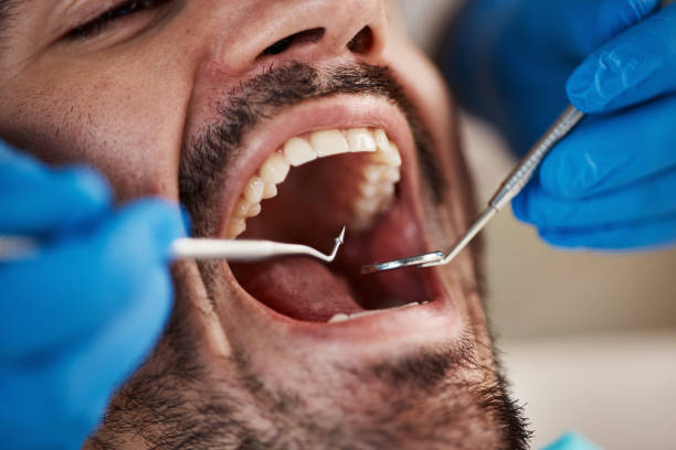 Best Dentist for Dental Trauma  in Copperton, UT